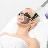 Carbon Laser Facial