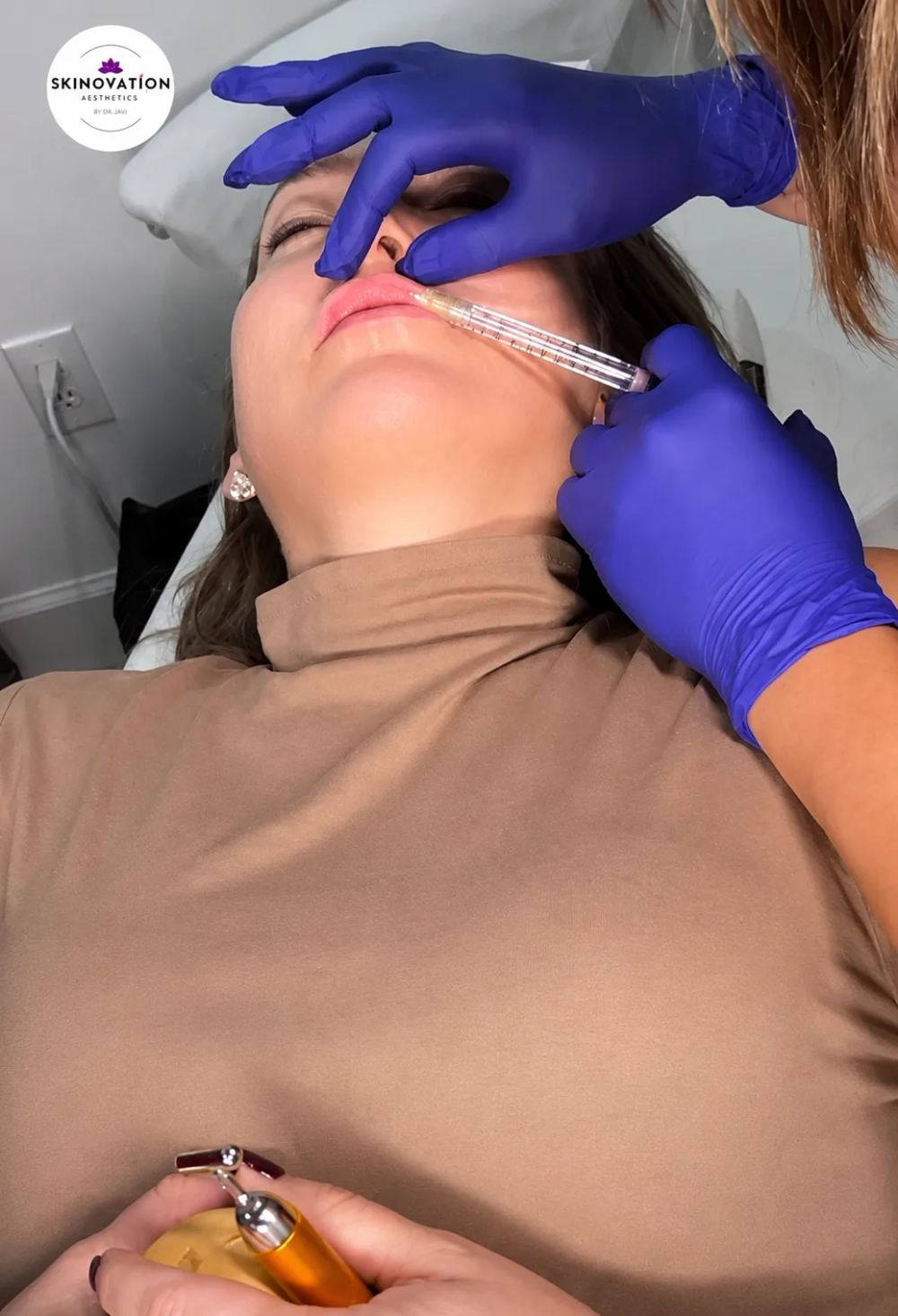 Dermal Fillers treatment