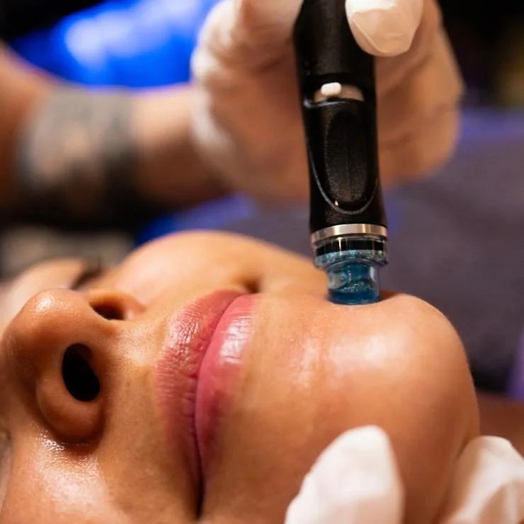 HydraFacial cleanse, extract and hydrate treatment steps