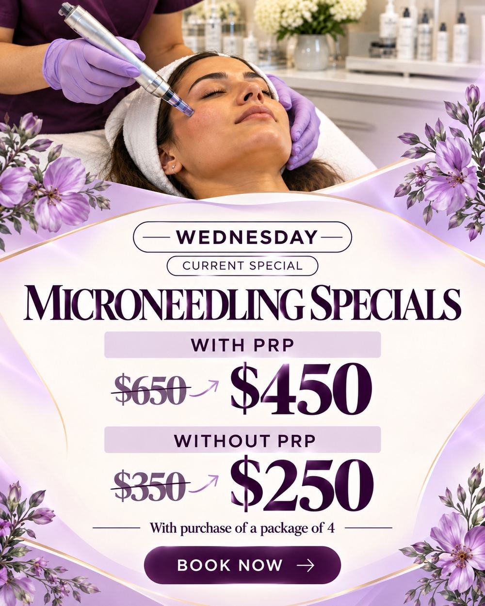 Skinovation microneedling specials: $450 per session with PRP or $250 without PRP, with a four-session package