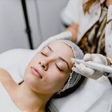 Microneedling