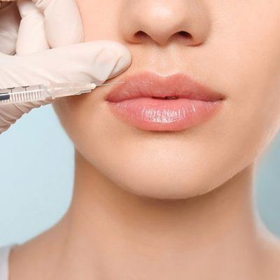 Lip filler treatment performed by an aesthetic provider