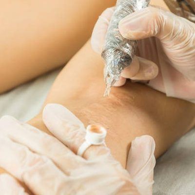 Aesthetic provider performing a precision skin treatment